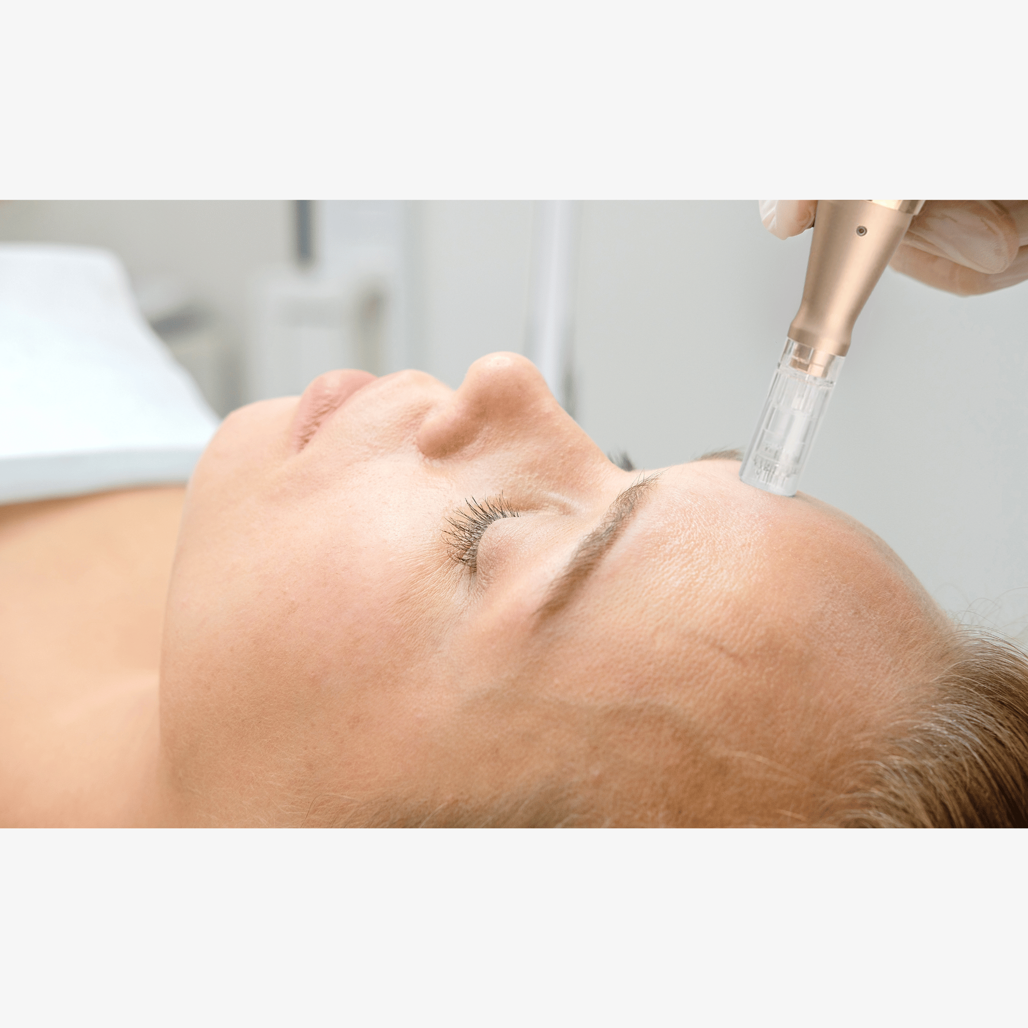 woman having microneedling treatment done using dr pen m5