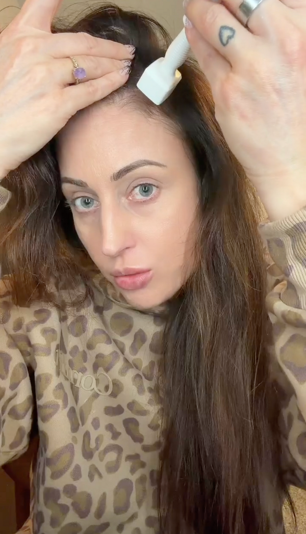 Nikki review of our beautimate bundle for hair growth- derma stamp and rosemary oil