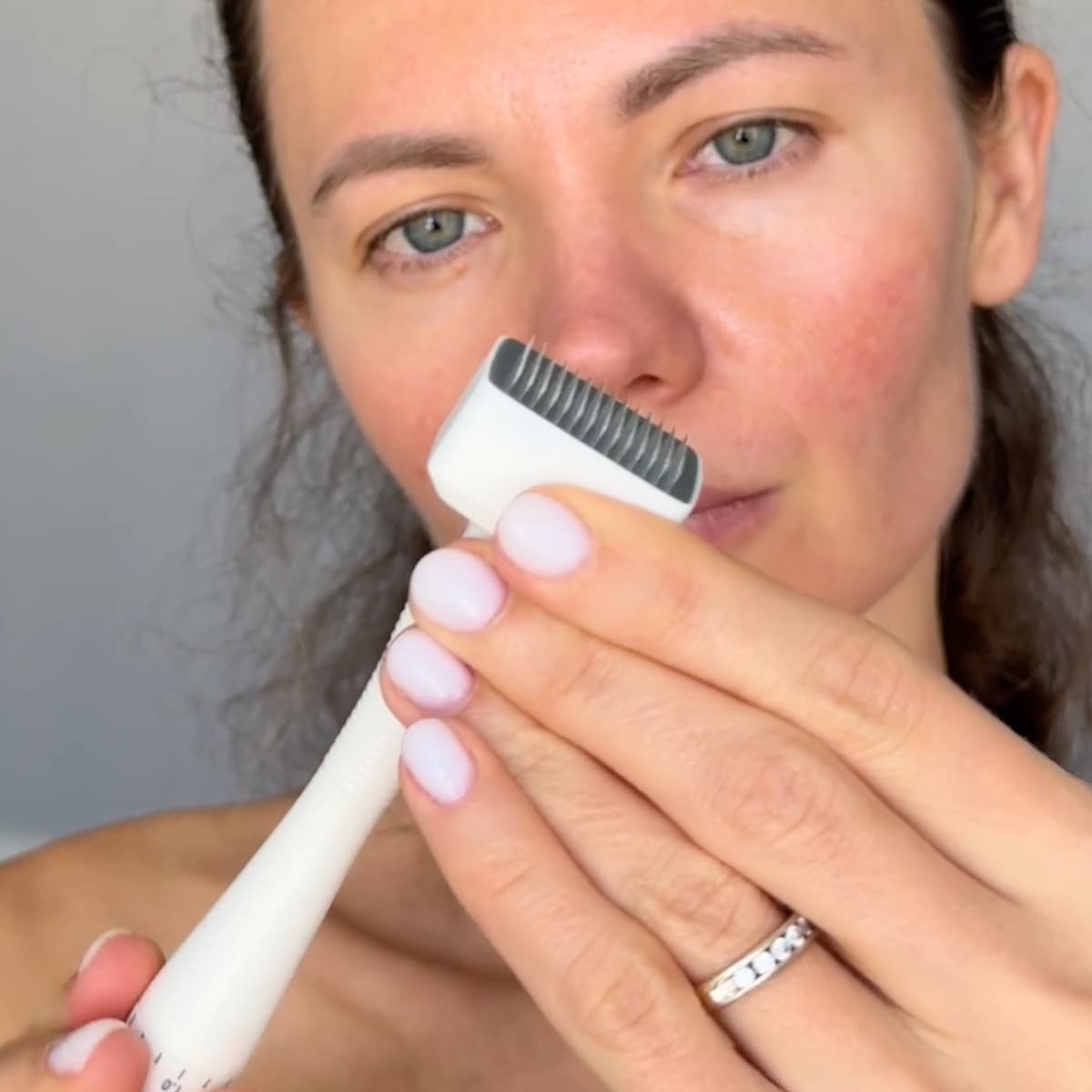 Close-up of Derma Stamp’s fine titanium needle tip for targeted microneedling treatments